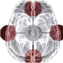 Silicon Brain